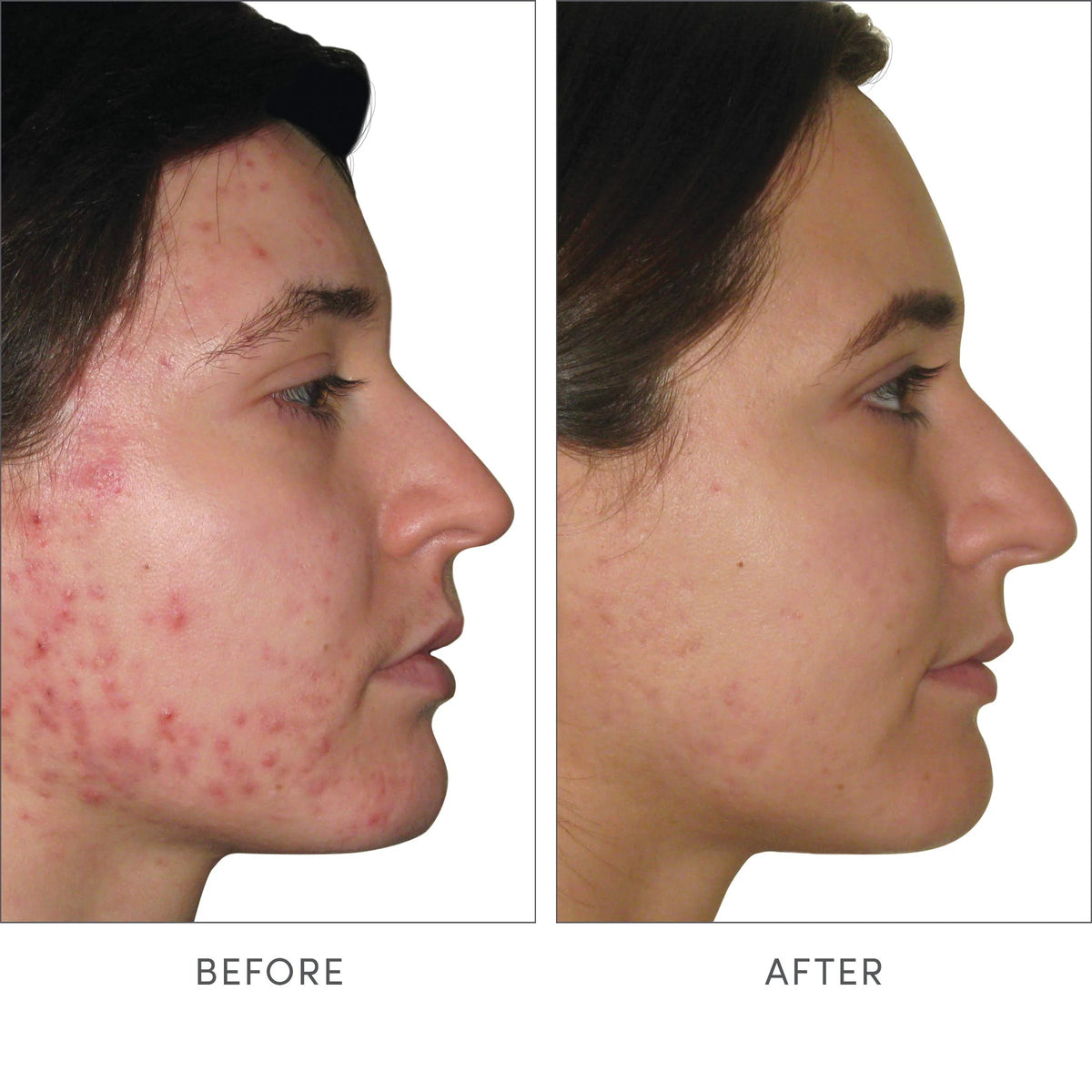 Skin Accumax Supplement P18973